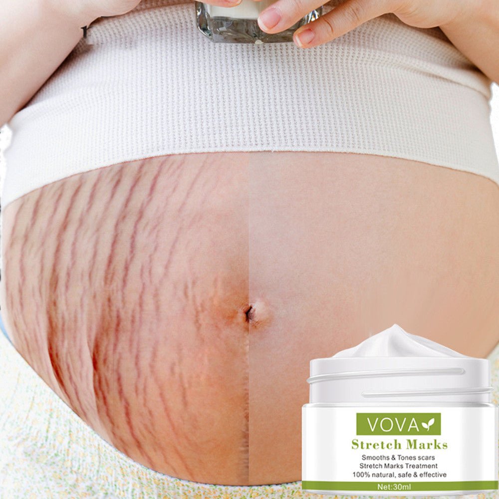 Anti-Stretch Marks Scar Removal Cream